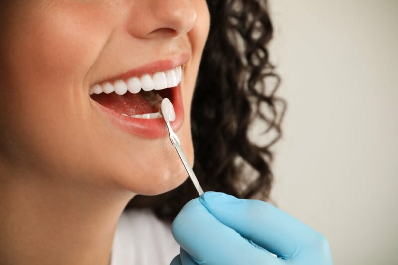 Dental Crowns Dallas