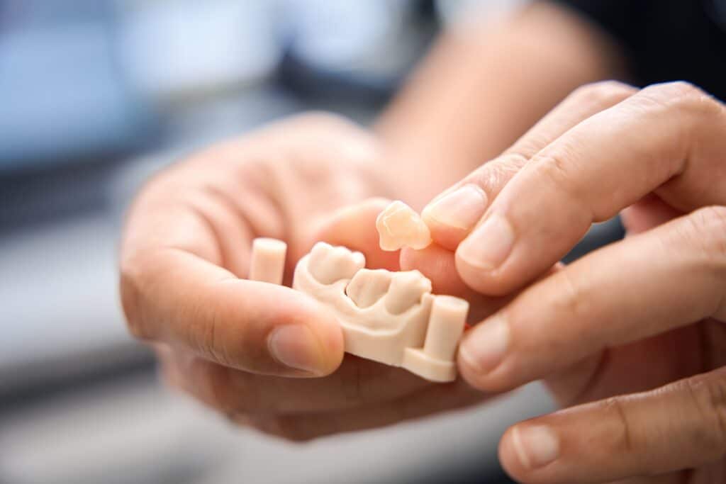 Dental Crowns Dallas